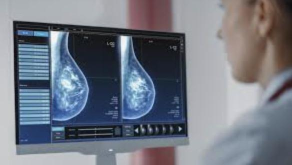 乳腺癌中的多模态大模型评估