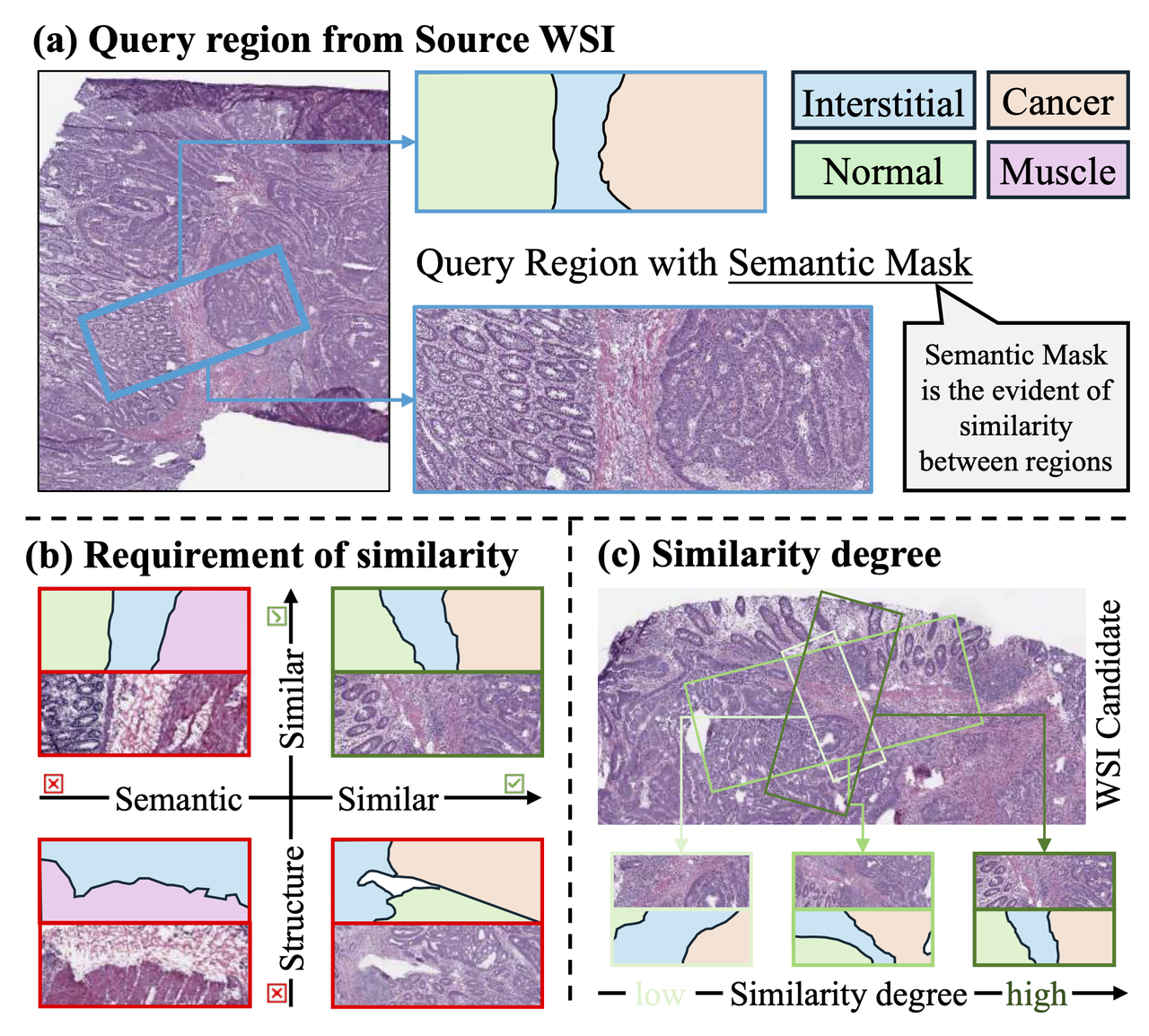 URICA:病理切片检索系统